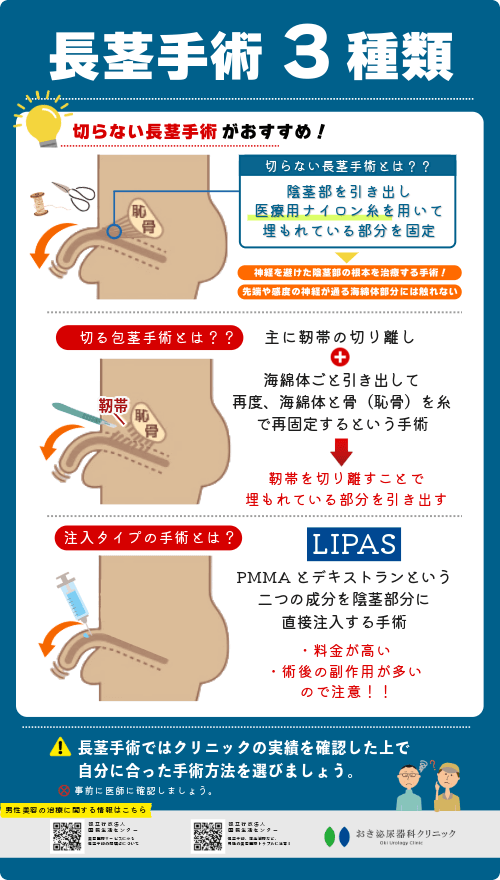 長茎手術の方法３種類「切らない長茎手術・切る長茎手術・注入タイプの長茎手術」を解説する画像